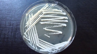 Streak Plate Method - Amrita University