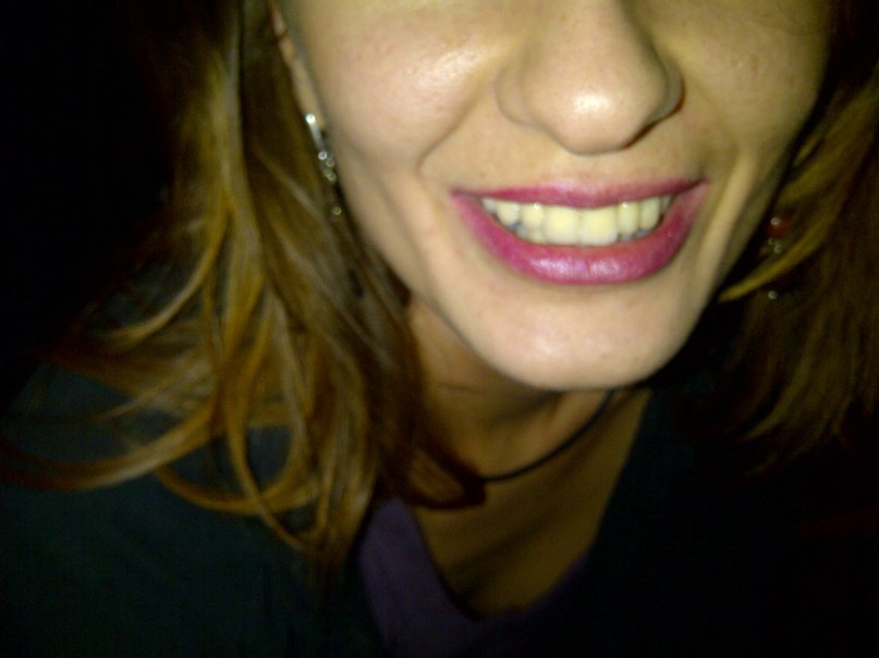 Almaz Ayupov | Москва