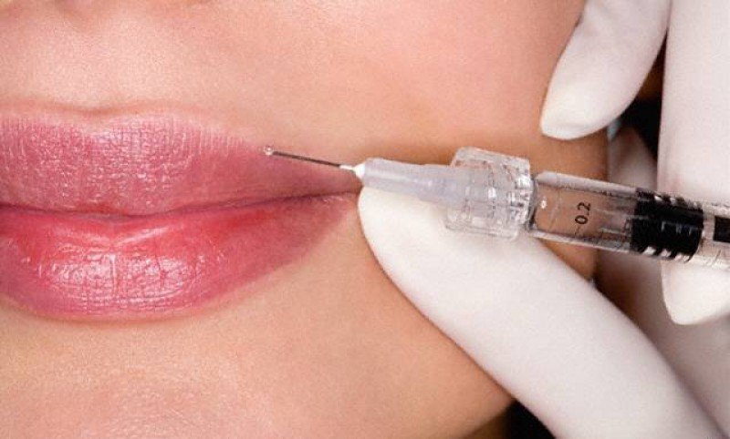 Алёна Музес | Москва